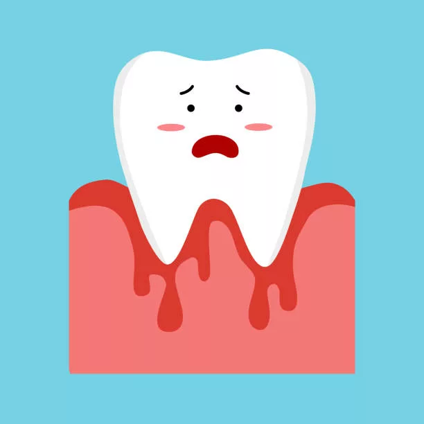 Traitement de la gingivite en MTC – Dr Franck Ponsaty