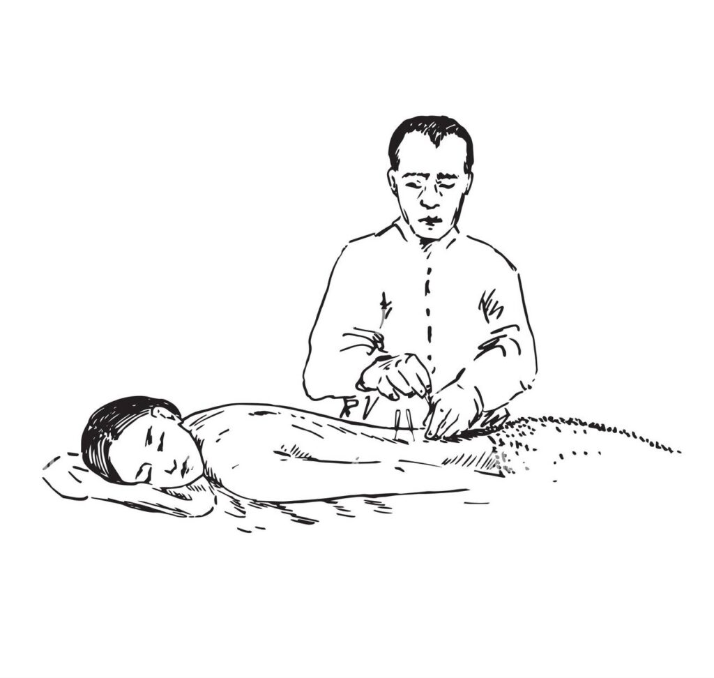 Acupuncture et cancérologie