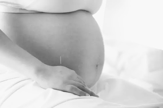 Grossesse et acupuncture
